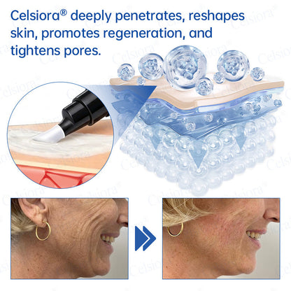 🥈🎁UK HOT SALE Celsiora® PDRN Anti-Wrinkle Shot – Lift & Firming Cream