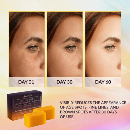 Avoryla Kojic Acid Dark Spot Remover Soap | Vitamin C + Retdinol + Turmeric | Japanese Complex