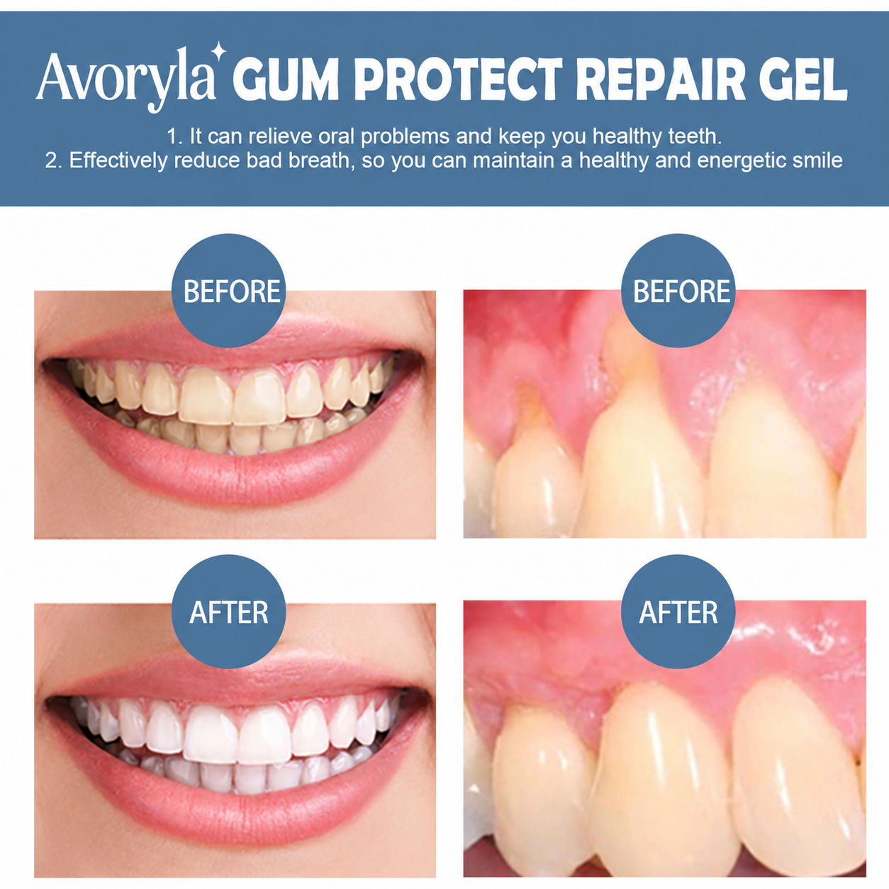 Avoryla Gum Protect Repair Gel — Rebuild Gums, Reduce Inflammation & Restore Your Smile