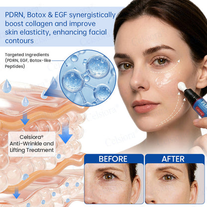🥈🎁UK HOT SALE Celsiora® PDRN Anti-Wrinkle Shot – Lift & Firming Cream